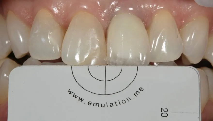 Case 6 Before