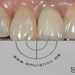 Case 6 Before