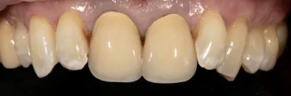 Case 5 Before