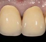Case 5 Before