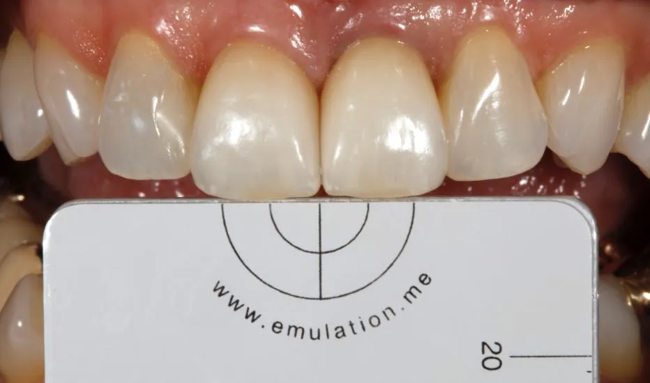 Case 6 After