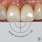 Case 6 After