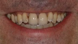 Case 4 Before